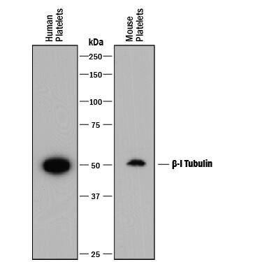 Detection of Human and Mouse  beta-I Tubulin antibody by Western Blot.