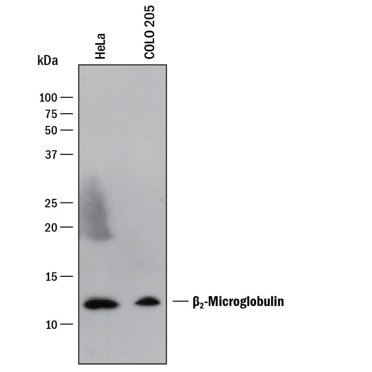 Detection of Human  beta2-Microglobulin antibody by Western Blot.