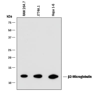 Detection of Mouse  beta2-Microglobulin antibody by Western Blot.