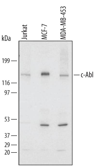 Detection of Human c-Abl antibody by Western Blot.