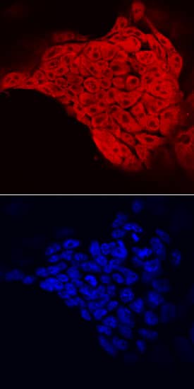 c-Myc antibody in D3 Mouse Stem Cells by Immunocytochemistry (ICC).