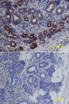 cIAP-1/HIAP-2 antibody in Human Lymphoma by Immunohistochemistry (IHC-P).