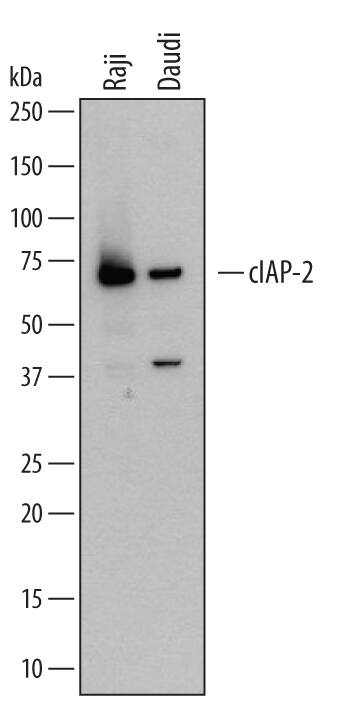 Detection of Human cIAP-2/HIAP-1 antibody by Western Blot.