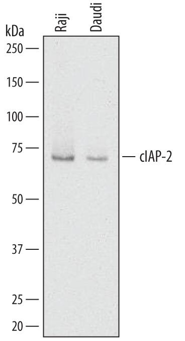 Detection of Human cIAP-2/HIAP-1 antibody by Western Blot.