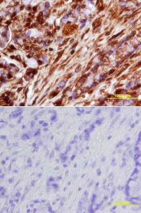 cIAP-2/HIAP-1 antibody in Human Colon by Immunohistochemistry (IHC-P).