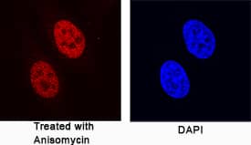 c-Jun antibody in HeLa Human Cell Line by Immunocytochemistry (ICC).