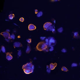 c-Myc antibody in HEK293 Human Cell Line Transfected with c-Myc-tagged Serotonin Receptor by Immunocytochemistry (ICC).