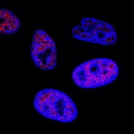 c-Myc antibody in HeLa Human Cell Line by Immunocytochemistry (ICC).