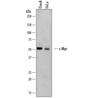 Detection of Human c-Myc antibody by Western Blot.