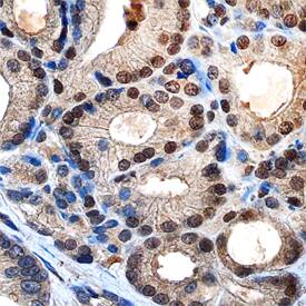 c-Myc antibody in Human Prostate by Immunohistochemistry (IHC-P).