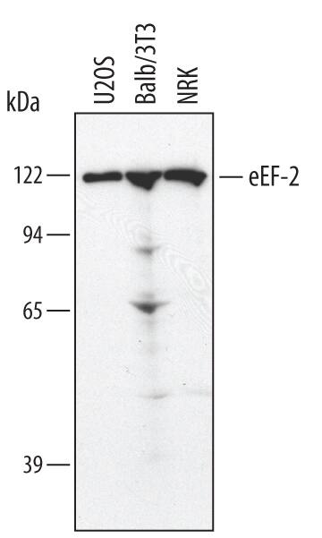 Detection of Human/Mouse/Rat eEF-2 antibody by Western Blot.