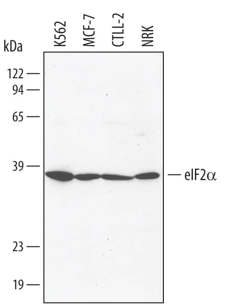 Detection of Human eIF2a antibody by Western Blot.