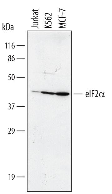 Detection of Human eIF2a antibody by Western Blot.