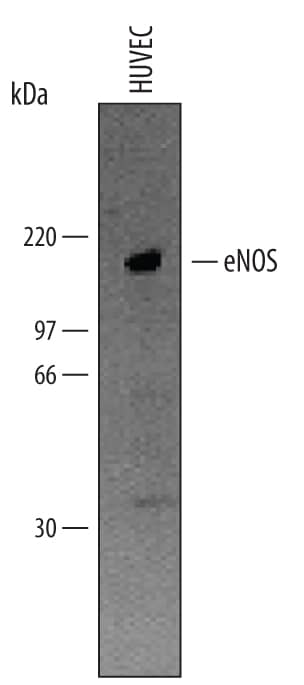 Immunoprecipitation of Human eNOS.