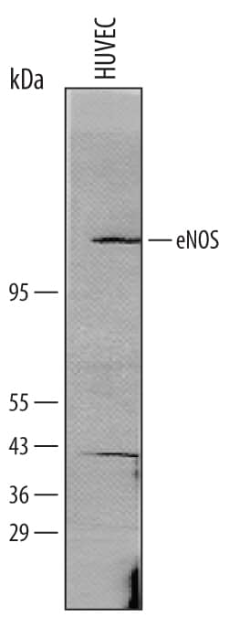 Detection of Human eNOS antibody by Western Blot.