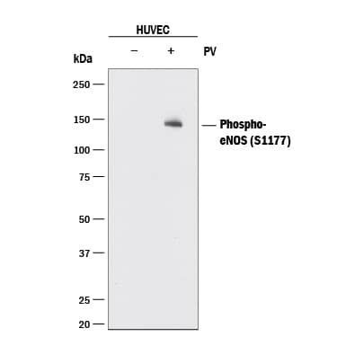 Detection of Human eNOS antibody by Western Blot.