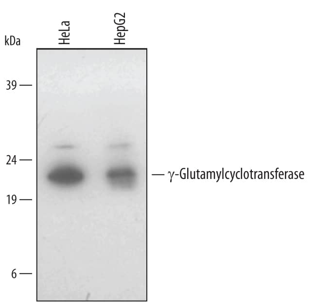 Detection of Human ?-Glutamylcyclotransferase/CRF21 antibody by Western Blot.