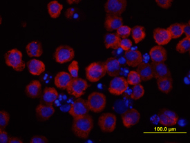 gp130 antibody in M1 Mouse Cell Line by Immunocytochemistry (ICC).