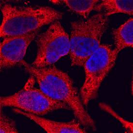 gp96/HSP90B1 antibody in HeLa Human Cell Line by Immunocytochemistry (ICC).