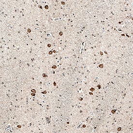 iNOS antibody in Human Brain by Immunohistochemistry (IHC-P).