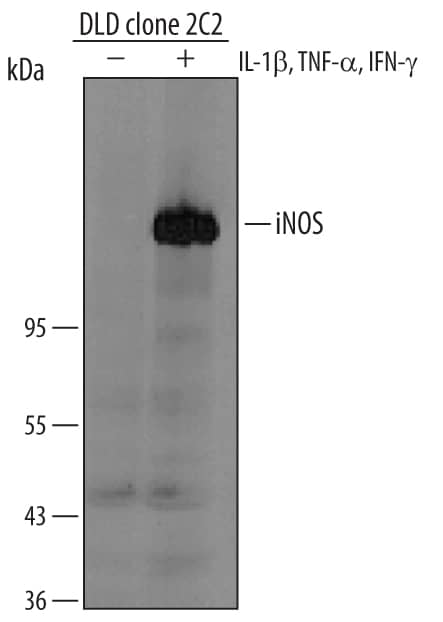 Detection of Human iNOS antibody by Western Blot.