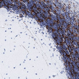 mGluR2 antibody in Human Brain by Immunohistochemistry (IHC-P).