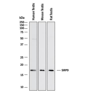 Detection of Human, Mouse, and Rat SIRP delta antibody by Western Blot.