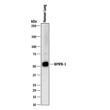 Detection of Human BPIFB1 antibody by Western Blot.