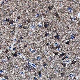 GPR158 in Human Brain Cortex Tissue.