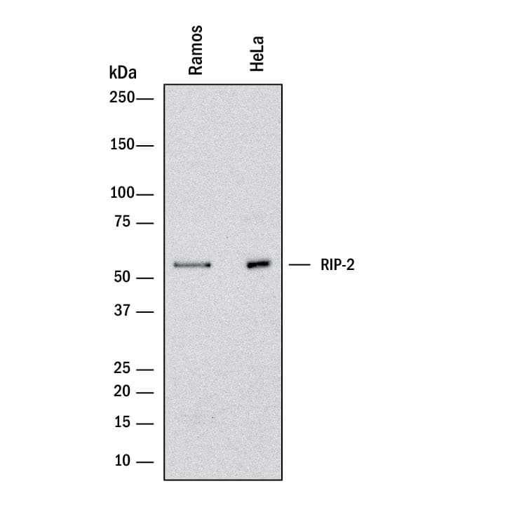 Detection of Human RIPK2/RIP2 antibody by Western Blot.