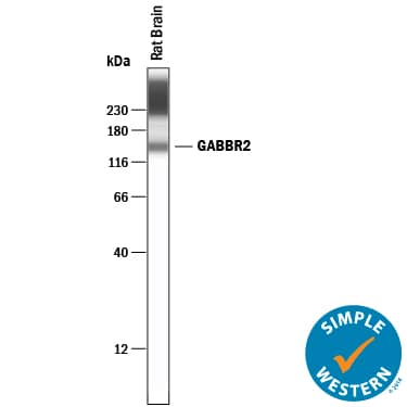 Detection of Rat GABAB R2 antibody by Simple WesternTM.
