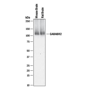 Detection of Mouse and Rat GABAB R2 antibody by Western Blot.