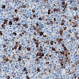PD-1 antibody in Human Tonsil by Immunohistochemistry (IHC-P).