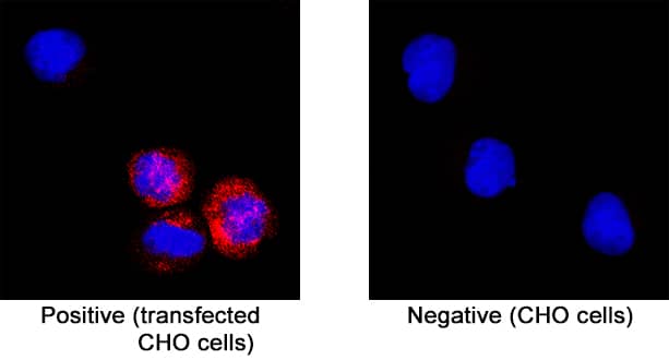 SARS-CoV-2 Envelope in CHO Chinese hamster cell line transfected.