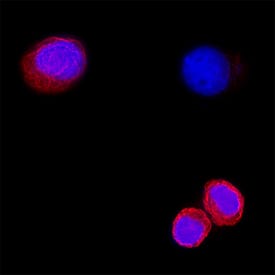 Detection of Cytokeratin 7 in SK-BR-3 Human Cell Line.