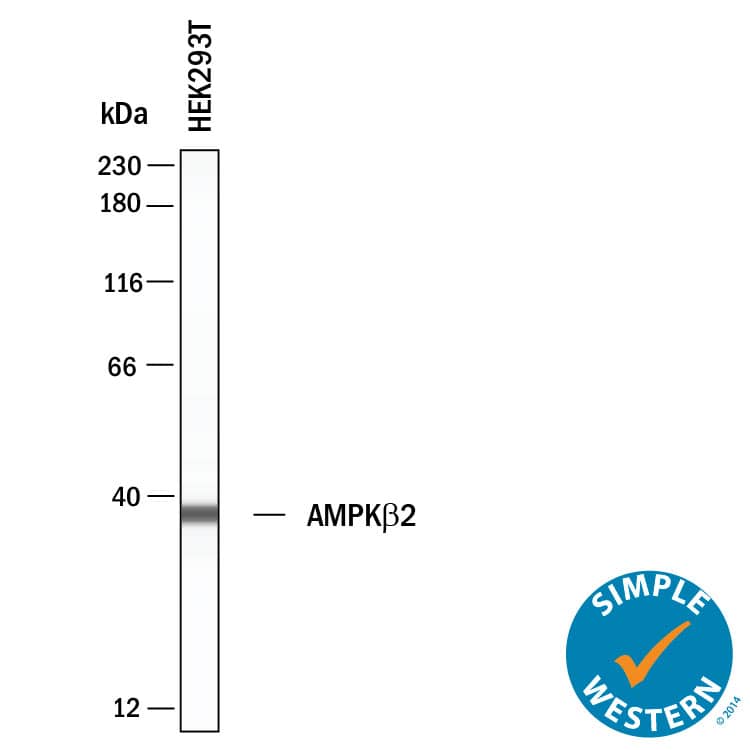 Detection of Human AMPK beta2 by Simple Western<sup>TM</sup>.