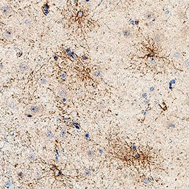 Detection of Aquaporin 4/AQP4 in Human Brain Cortex.