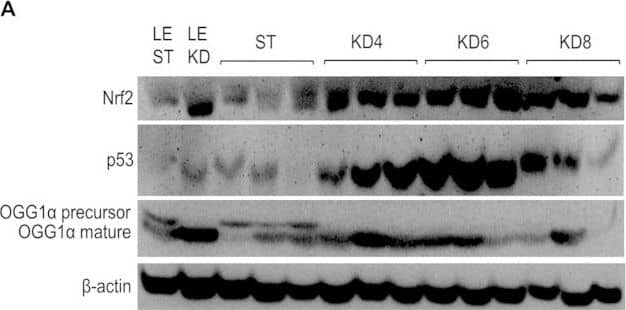 Detection of Rat p53 by Western Blot