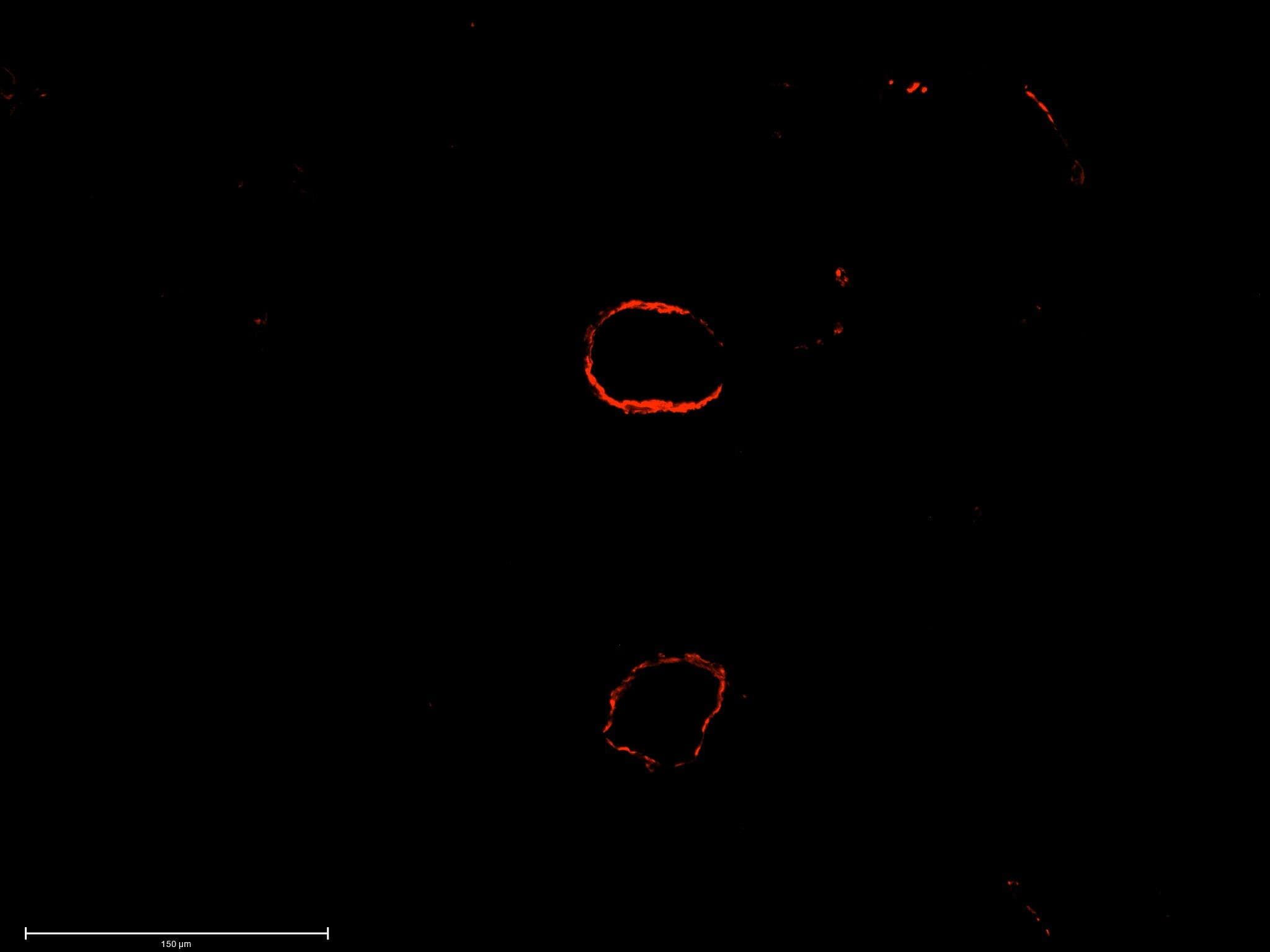 Detection of alpha-Smooth Muscle Actin in Mouse Lung.