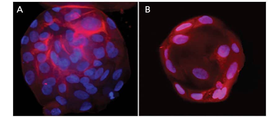 Immunofluorescent Staining of Adult Stem Cell-derived Liver Organoids.