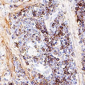 Akt Pan Specific antibody in Mouse Spleen Tissue by Immunohistochemistry (IHC-P).