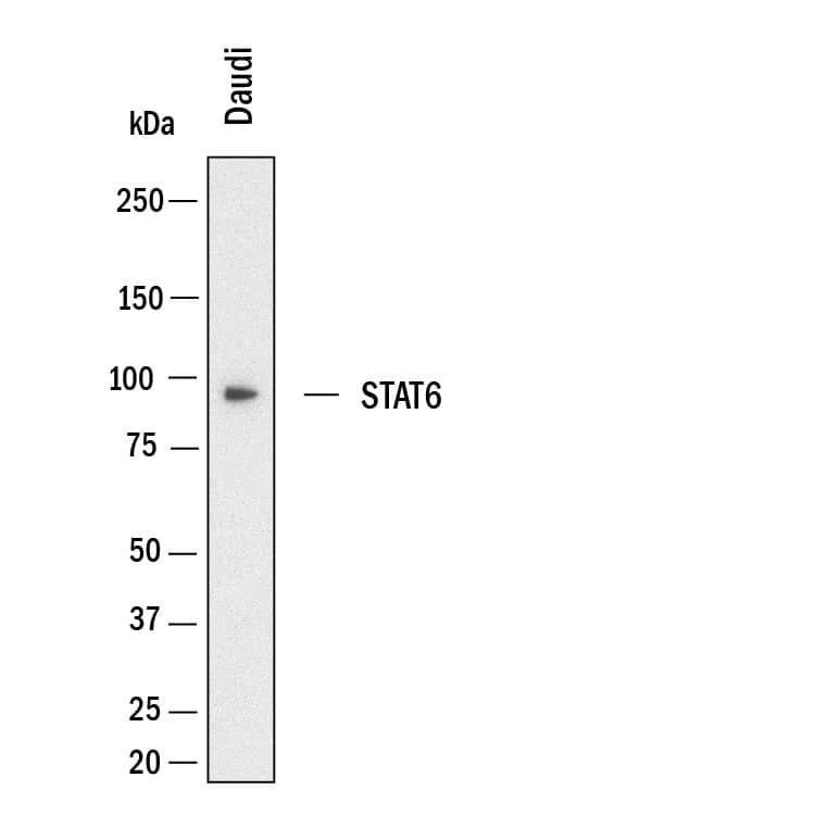 Detection of Human STAT6 by Western Blot.