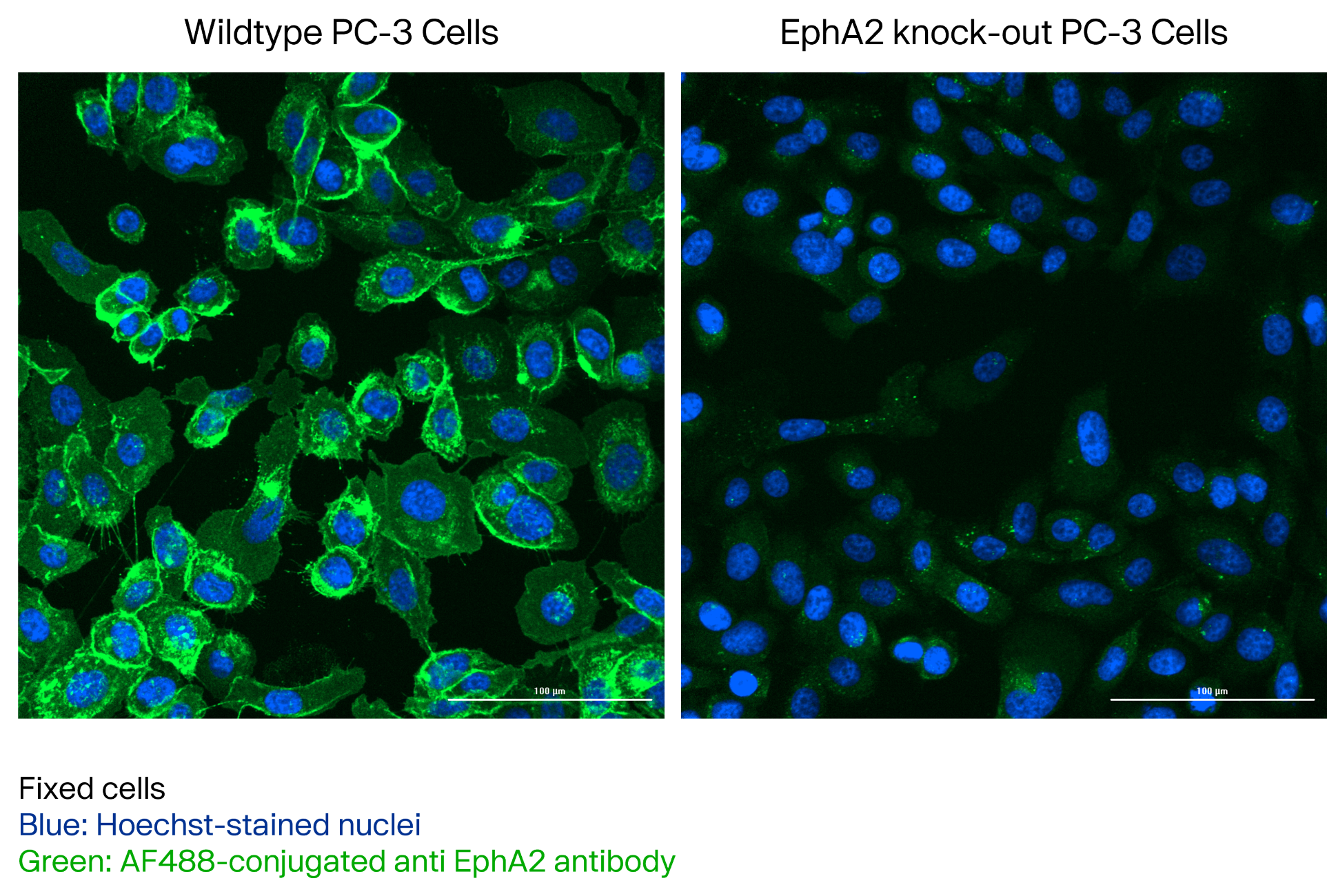 EphA2 in PC-3 Human Prostate Cancer Cell Line.