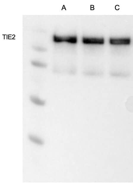 Detection of Human Tie‑2 by Western Blot.