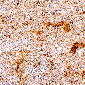 mGluR3 antibody in Human Hypothalamus Tissue by Immunohistochemistry (IHC-P).