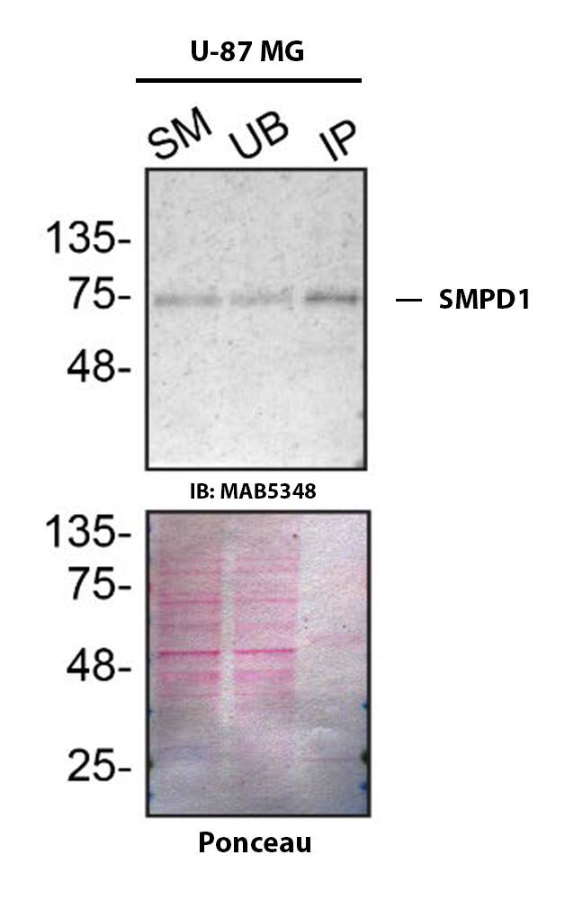 Detection of SMPD1 by Immunoprecipitation.