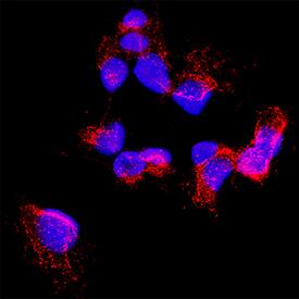 Carboxylesterase 2/CES2 antibody in A431 Human Cell Line by Immunocytochemistry (ICC).