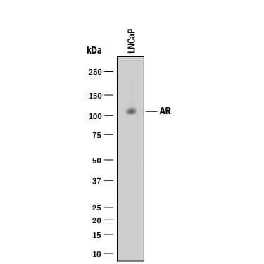 Detection of Human Androgen R/NR3C4 antibody by Western Blot.