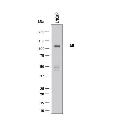 Detection of Human Androgen R/NR3C4 antibody by Western Blot.