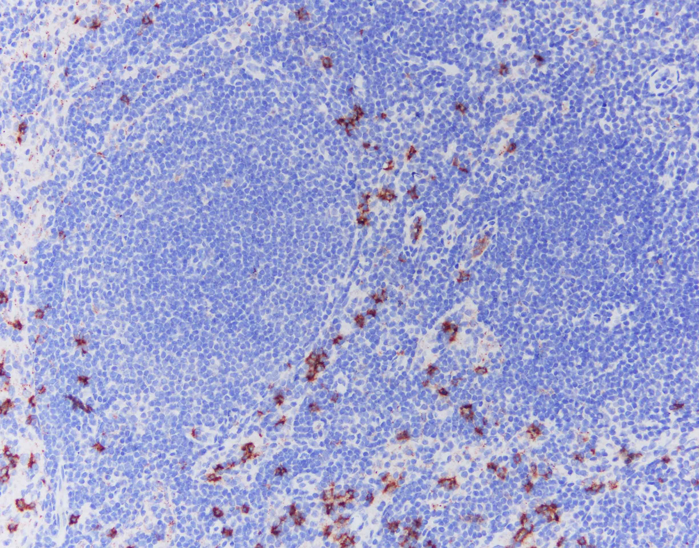 IL‑5 in Human Lymph Node Tissue.